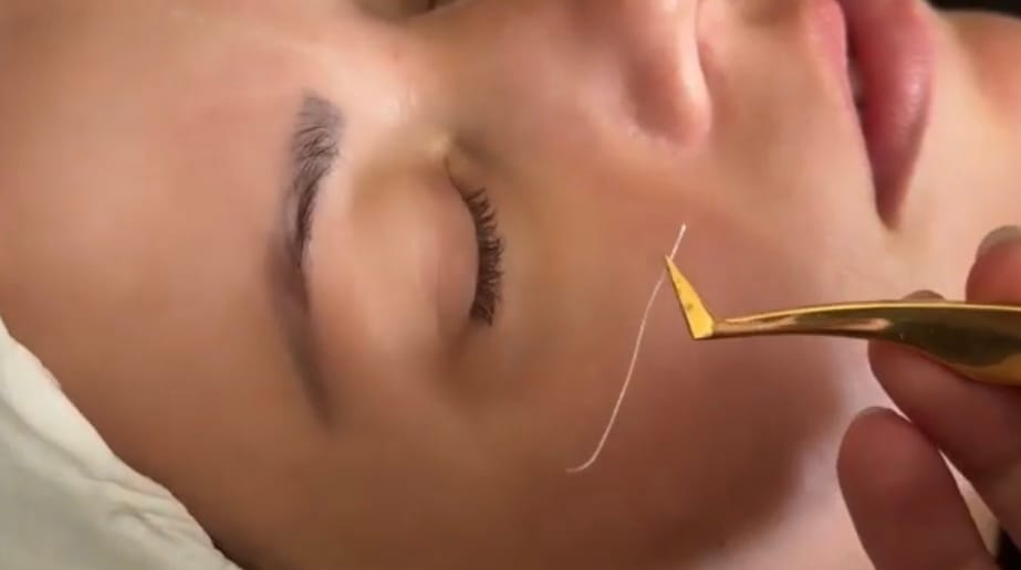 Kolagenové Nitě Online Kurz